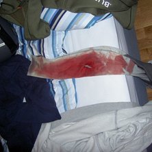 Skar mig lite p&aring; st&aring;lkanten..... 9 stygn... Kuva: Filip Alexandersson. Ratsastaja: Filip Alexandersson.